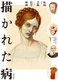 描かれた病―疾病および芸術としての医学挿画